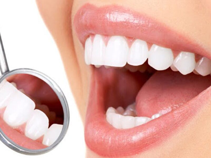 مراحل تقويم الاسنان