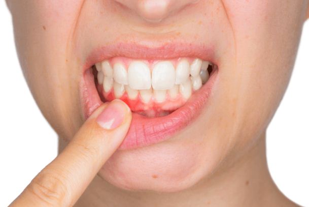 مخاطر زراعة الاسنان