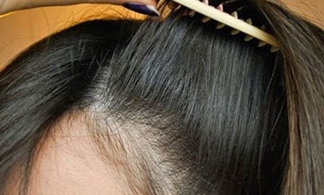 كيفية علاج تساقط الشعر بعد البروتين