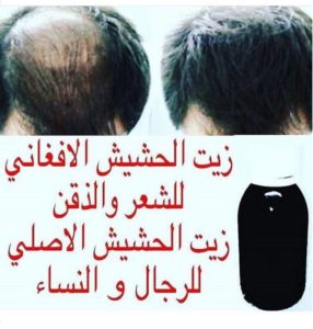 زيت الحشيش لتطويل الشعر بسرعه 0540428830 5 نصائح من الخبراء