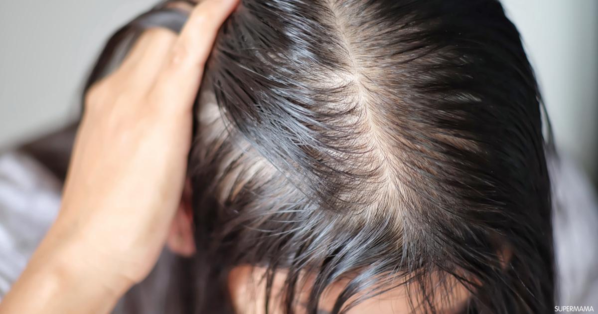 اخصائية علاج تساقط الشعر