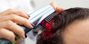 اسعار عمليات زراعة الشعر في تركيا