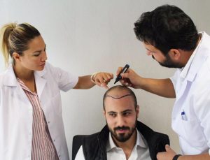 تقييم افضل مراكز زراعة الشعر في تركيا