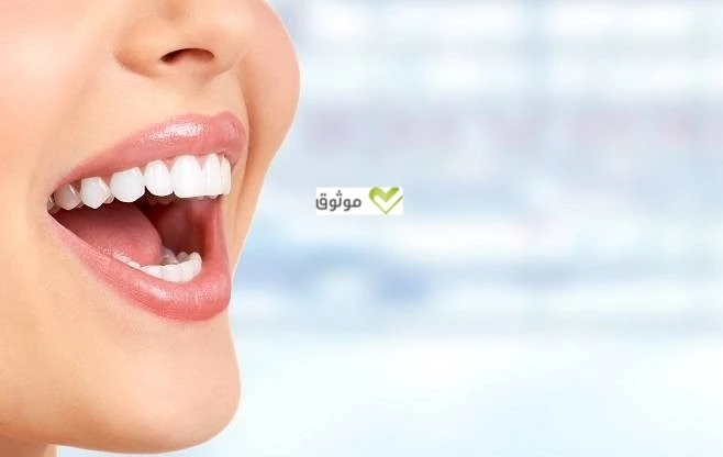 مراكز تجميل الاسنان في تركيا